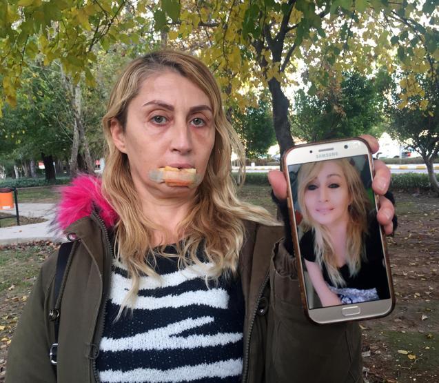 Güzellik uğruna sağlığını kaybetti