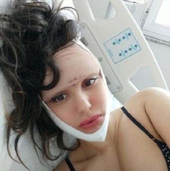 Estetik tutkusu yüzünden 23. ameliyatını olacak