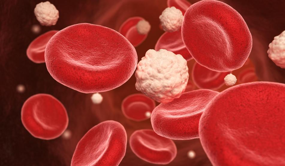 Kanseri geçerek dünyada en fazla ölüme neden olan hastalık: Sepsis