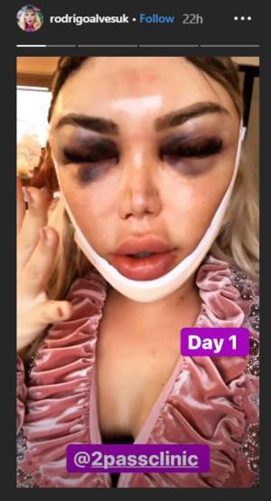Rodrigo Alves: Yeni yüzümü göremiyorum
