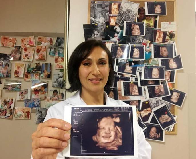 Anne karnındaki bebeklerin gülümseten pozları