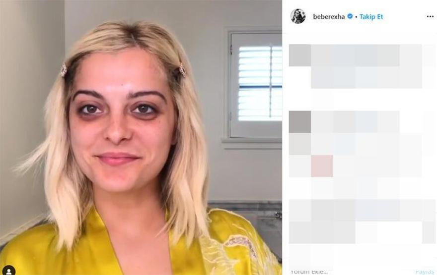 Göz altlarındaki morlukları böyle kapatın