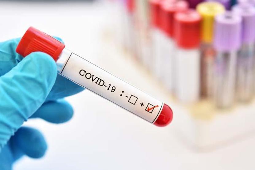 Koronavirüsün gözdeki belirtisine dikkat