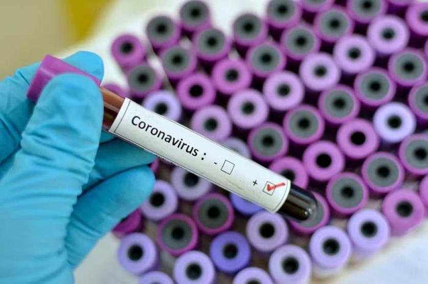 Koronavirüs vücudumuzu nasıl ele geçiriyor İşte organlara etkileri