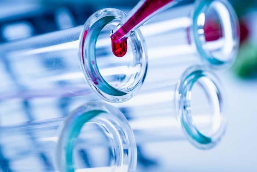 Koronavirüs hastalarında görülen 5 cilt hastalığı