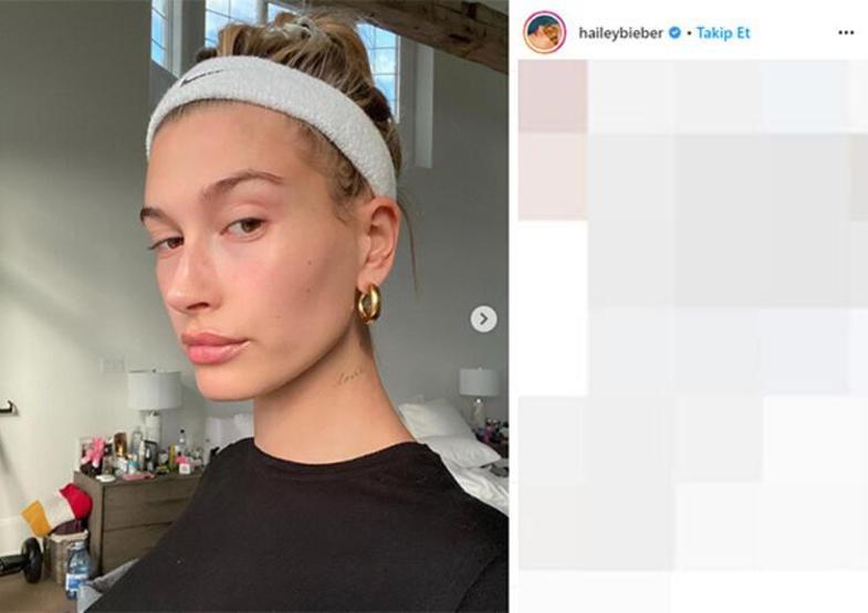 Hailey Baldwinden estetik iddialarına yanıt