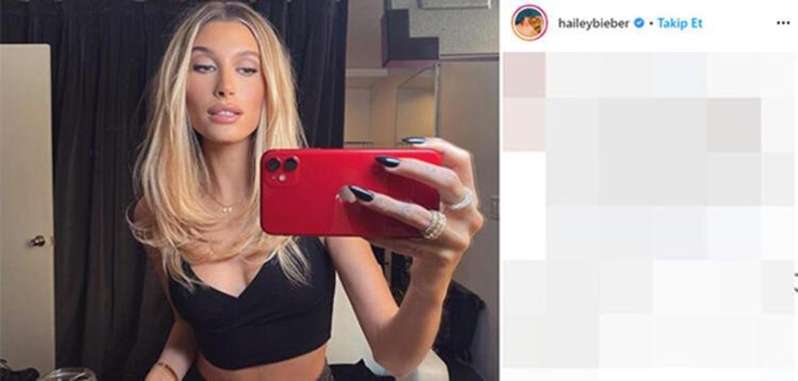 Hailey Baldwinden estetik iddialarına yanıt