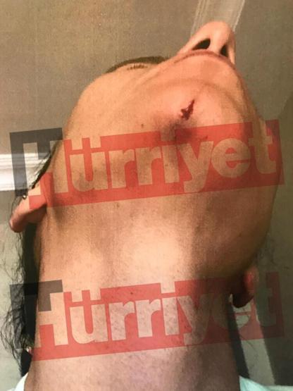 Son dakika... Ozan Güven - Deniz Bulutsuz olayıyla ilgili görüntüler dosyada