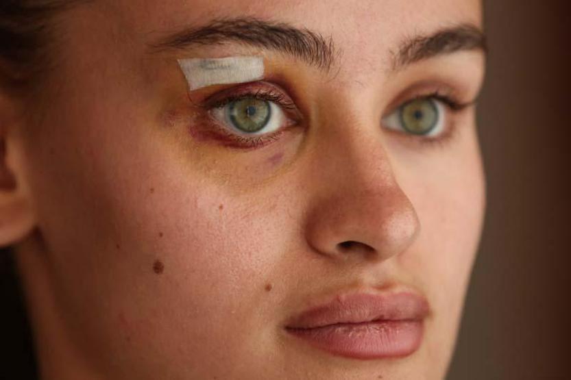 Son dakika... Ukraynalı modelin Daria Kyryliukun darp iddiasıyla ilgili görgü tanığı ifadesi ortaya çıktı