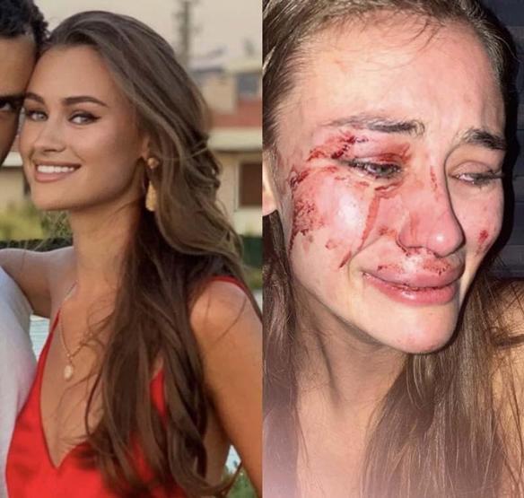 Son dakika... Ukraynalı modelin Daria Kyryliukun darp iddiasıyla ilgili görgü tanığı ifadesi ortaya çıktı