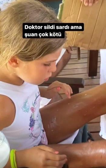 Yeliz Yeşilmenin kızının bacaklarına kaynar su döküldü