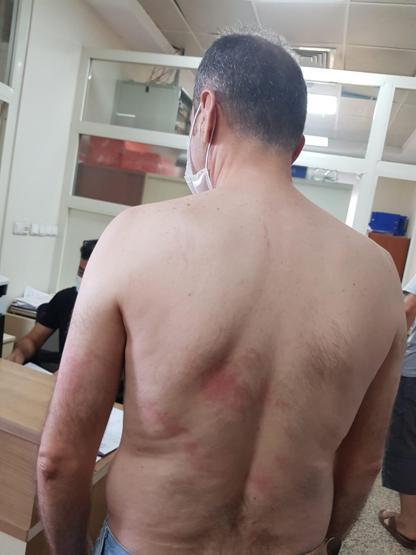Lisede skandal olay Engelli öğretmeni bu hale getirdi