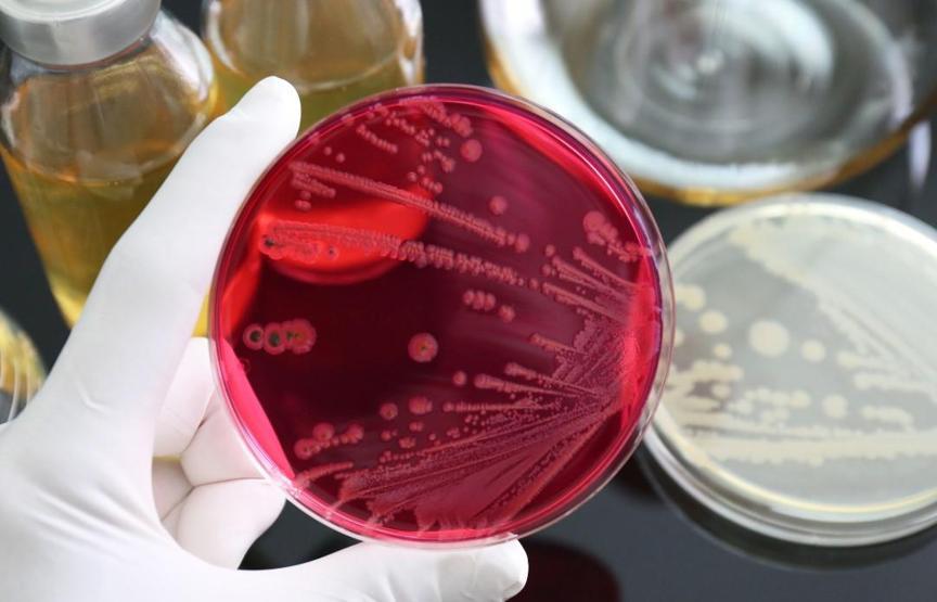 Ayran ve Tavukta Sessiz Tehdit Salmonella Gıda Zehirlenmesine Yol Açabilir