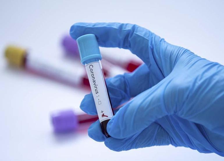 Süpermikrop: Antibiyotiklere dirençli bakteriler ‘koronavirüsten daha riskli olabilir’