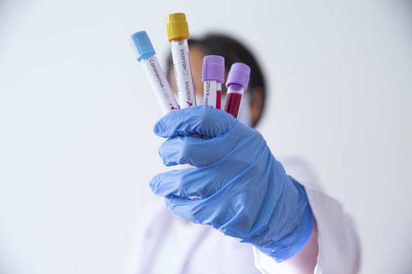 Süpermikrop: Antibiyotiklere dirençli bakteriler ‘koronavirüsten daha riskli olabilir’