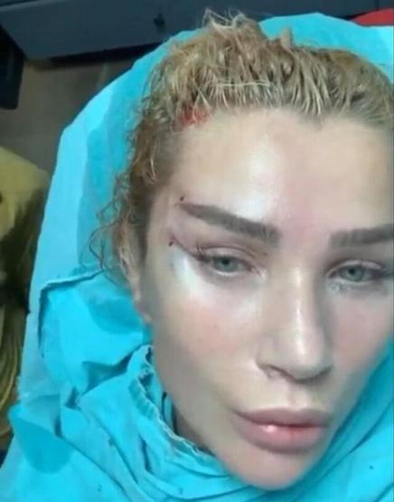 Sefa Doğanay: İp askı yaptırdım bacım