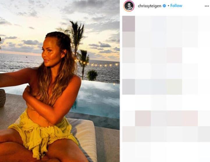 Chrissy Teigenın düşük yaptığı anların fotoğraflanması tartışma yarattı