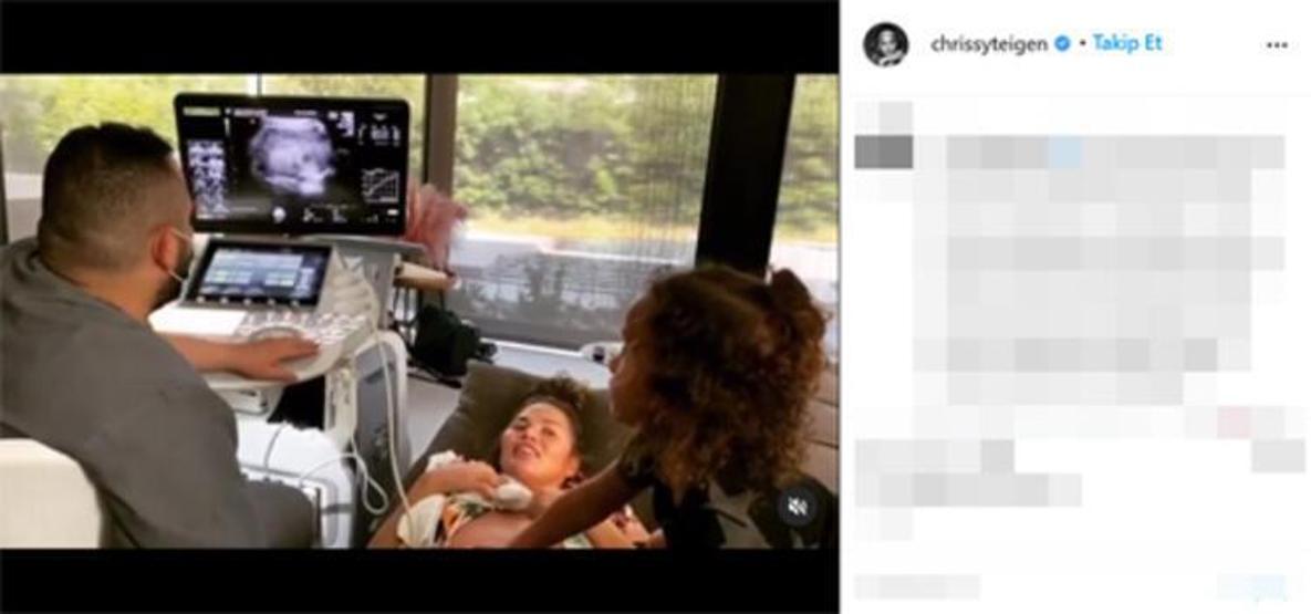 Chrissy Teigenın düşük yaptığı anların fotoğraflanması tartışma yarattı
