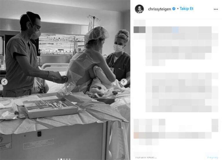 Chrissy Teigenın düşük yaptığı anların fotoğraflanması tartışma yarattı
