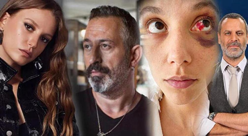 Serenay Sarıkaya göğüs estetiği mi oldu