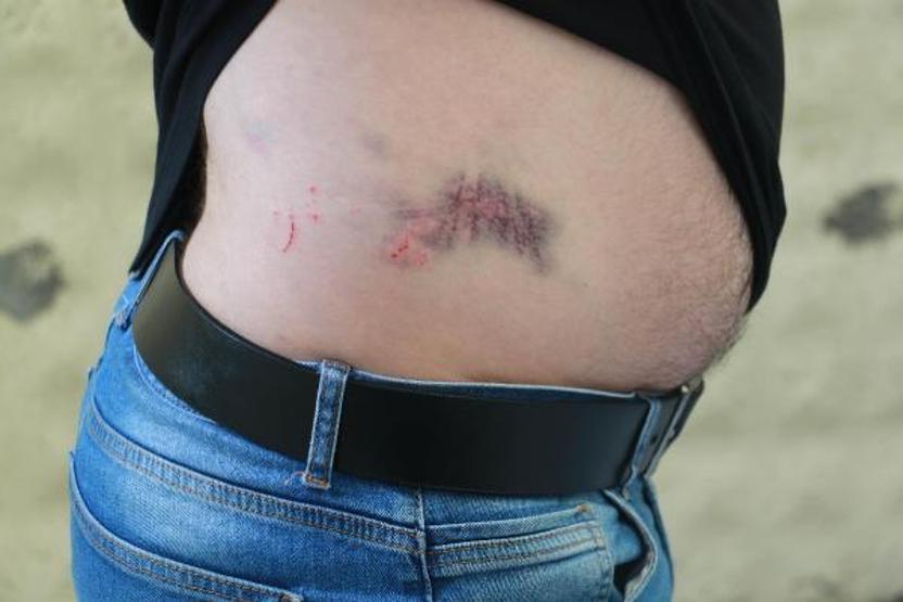 Darp edilen hasta bakıcı: İnsanların stres topu olmaktan yorulduk