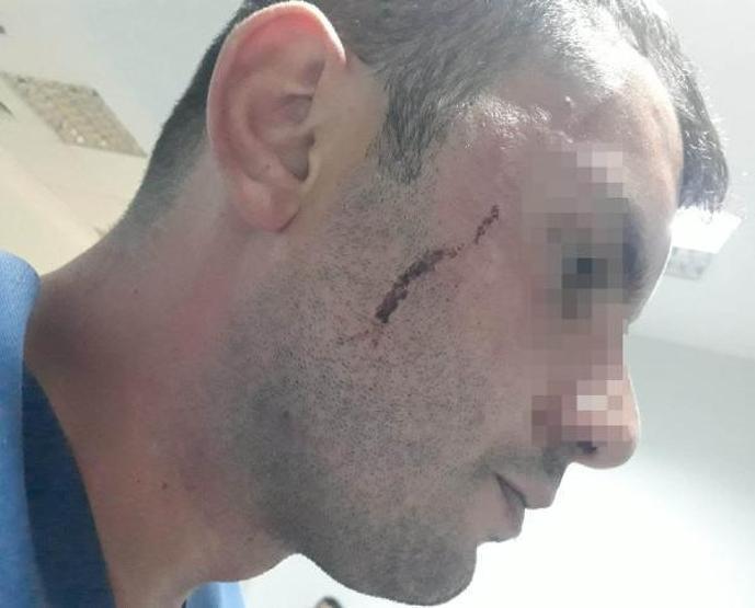 Darp edilen hasta bakıcı: İnsanların stres topu olmaktan yorulduk