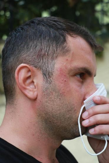Darp edilen hasta bakıcı: İnsanların stres topu olmaktan yorulduk