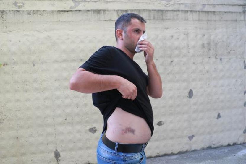 Darp edilen hasta bakıcı: İnsanların stres topu olmaktan yorulduk