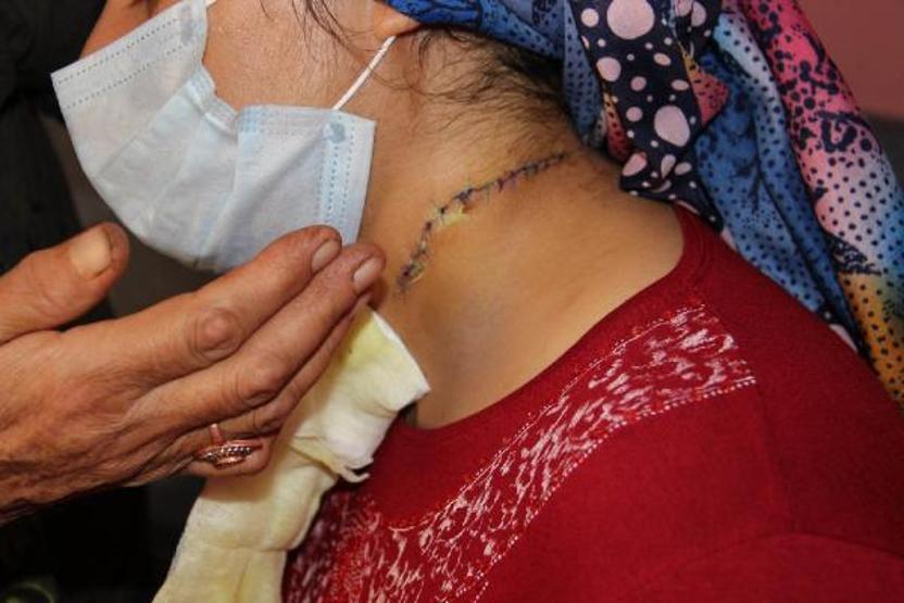 Boşanmak istediği eşi, çocuklarının önünde boğazını kesti