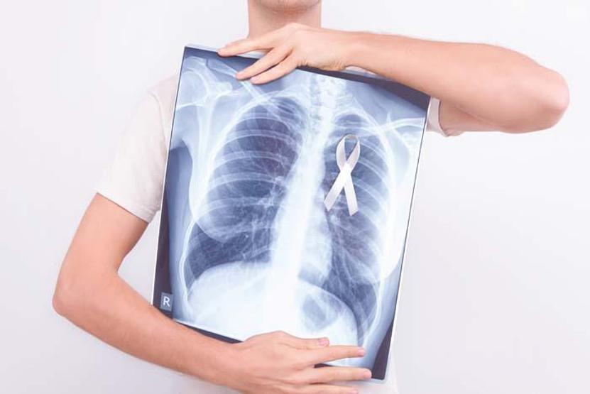 Akciğer tansiyonu nedir Bu belirtiler akciğer tansiyonu habercisi olabilir