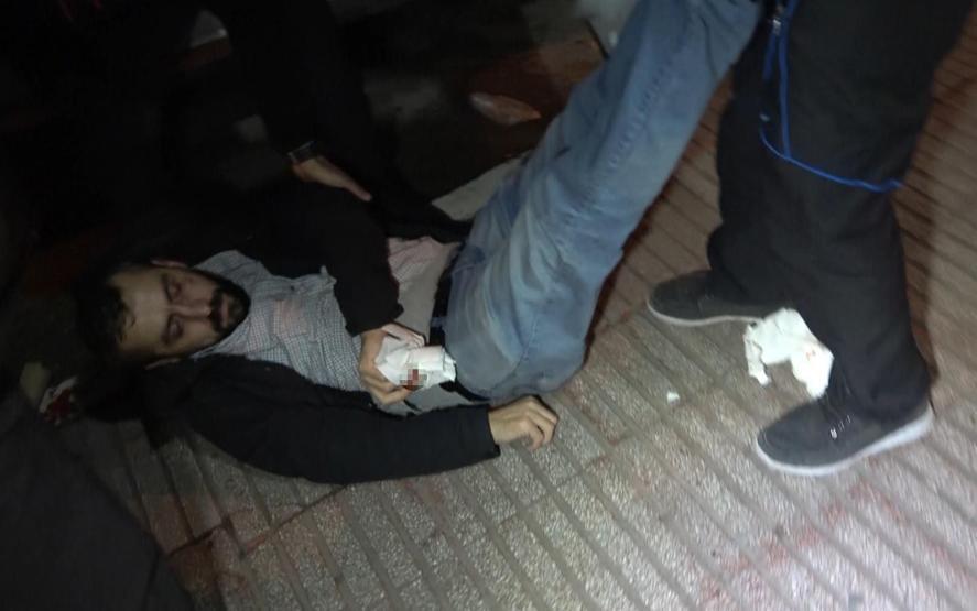 DHA muhabirine çirkin saldırı... Kısıtlamayı ihlal eden boksör, gazetecinin burnunu kırdı