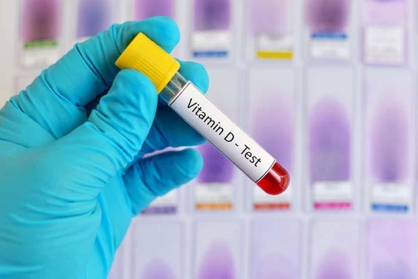 Güneşten sonra en fazla D vitamini bu besinde Salgın sürecinde mutlaka tüketin