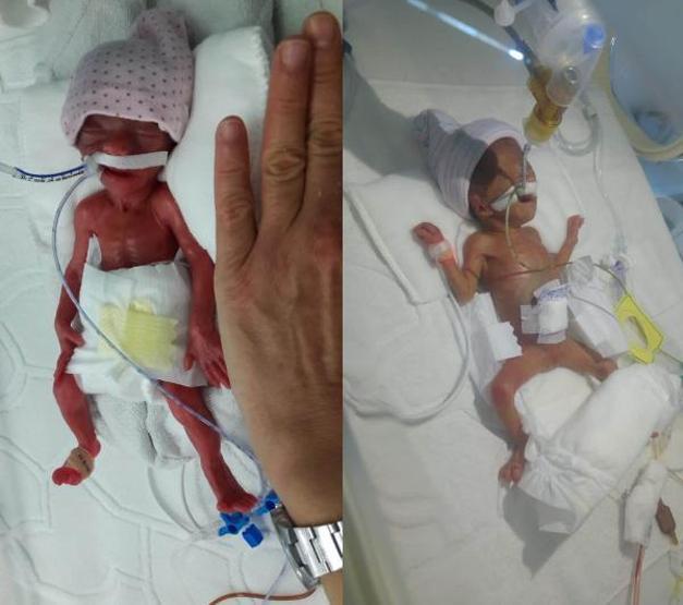 490 gram ve 680 gram doğan ikizler hayata tutundu
