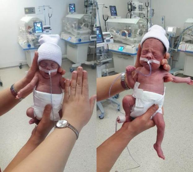 490 gram ve 680 gram doğan ikizler hayata tutundu