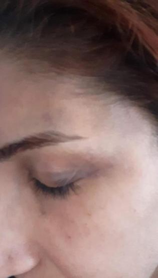 Ankarada veterinere sevgili şiddeti: Sadistlik boyutundaydı