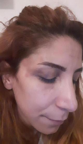 Ankarada veterinere sevgili şiddeti: Sadistlik boyutundaydı