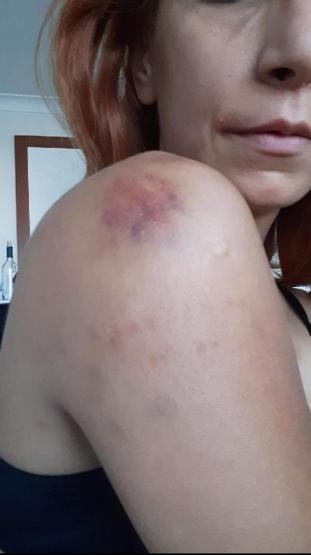 Ankarada veterinere sevgili şiddeti: Sadistlik boyutundaydı