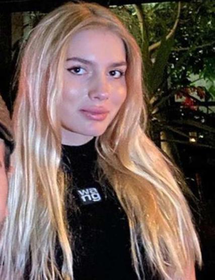 Aleyna Tilkinin yüzünde estetik var mı