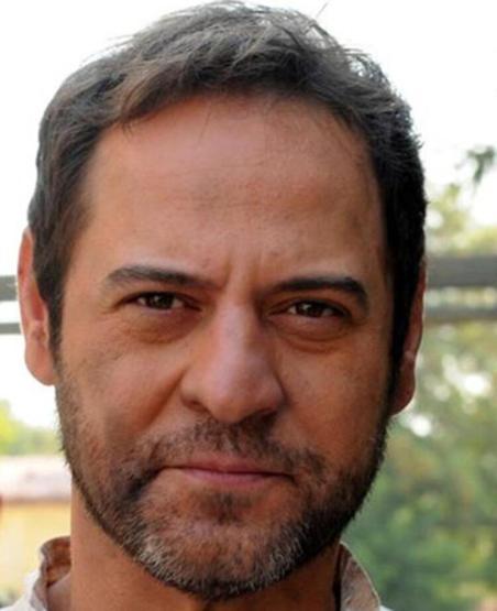 Tardu Flordun’un estetik operasyon olduğu ortaya çıktı