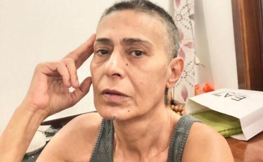 Yıldız Tilbe taklidini yapanlara sitem etti: Hepsini kınıyorum