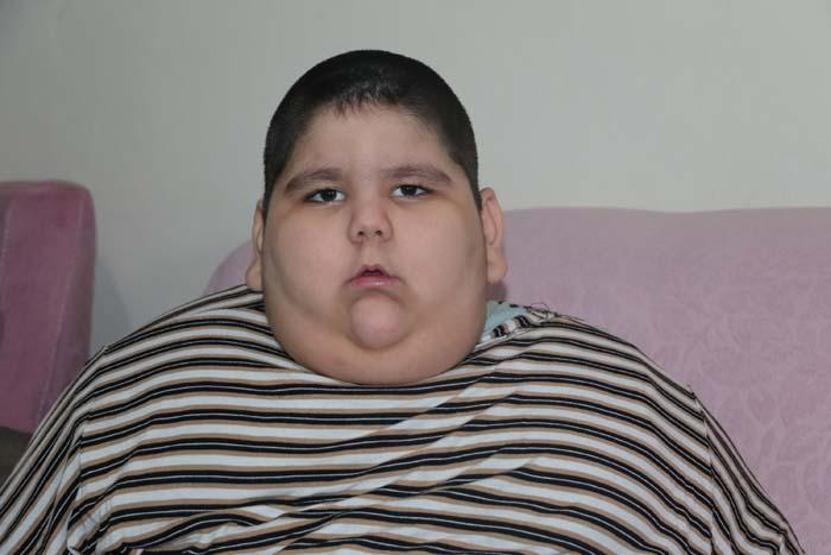 5 yaşındaki Yağız 90 kiloya ulaştı Geceleri solunum cihazına bağlı uyuyor