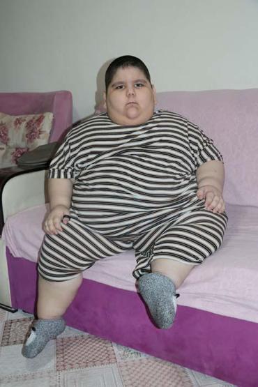 5 yaşındaki Yağız 90 kiloya ulaştı Geceleri solunum cihazına bağlı uyuyor