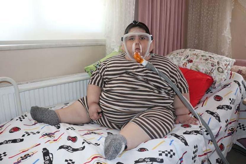 5 yaşındaki Yağız 90 kiloya ulaştı Geceleri solunum cihazına bağlı uyuyor