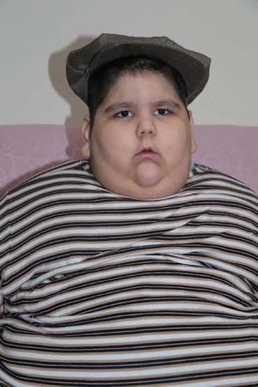 5 yaşındaki Yağız 90 kiloya ulaştı Geceleri solunum cihazına bağlı uyuyor