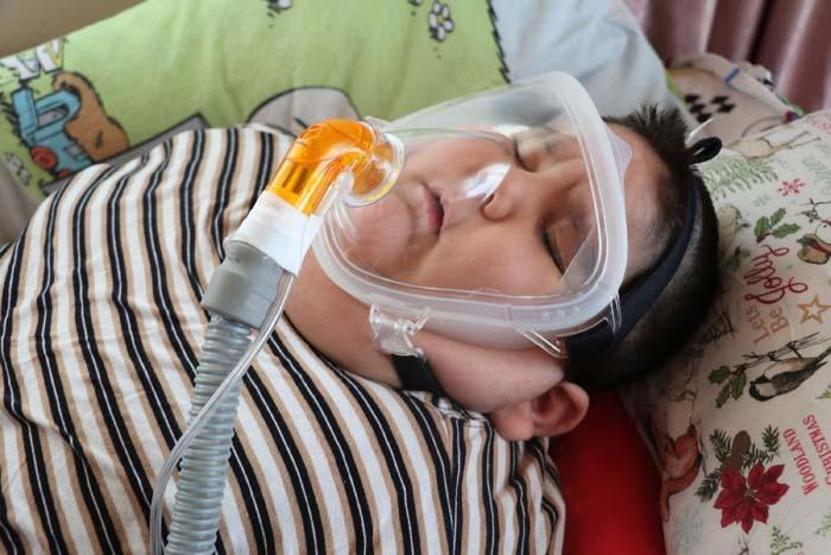 5 yaşındaki Yağız 90 kiloya ulaştı Geceleri solunum cihazına bağlı uyuyor