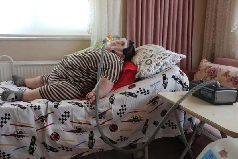 5 yaşındaki Yağız 90 kiloya ulaştı Geceleri solunum cihazına bağlı uyuyor