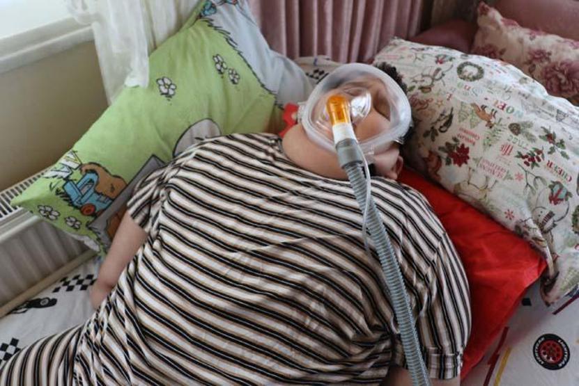 5 yaşındaki Yağız 90 kiloya ulaştı Geceleri solunum cihazına bağlı uyuyor