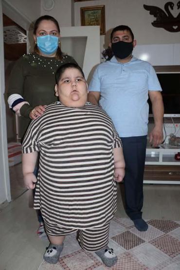 5 yaşındaki Yağız 90 kiloya ulaştı Geceleri solunum cihazına bağlı uyuyor