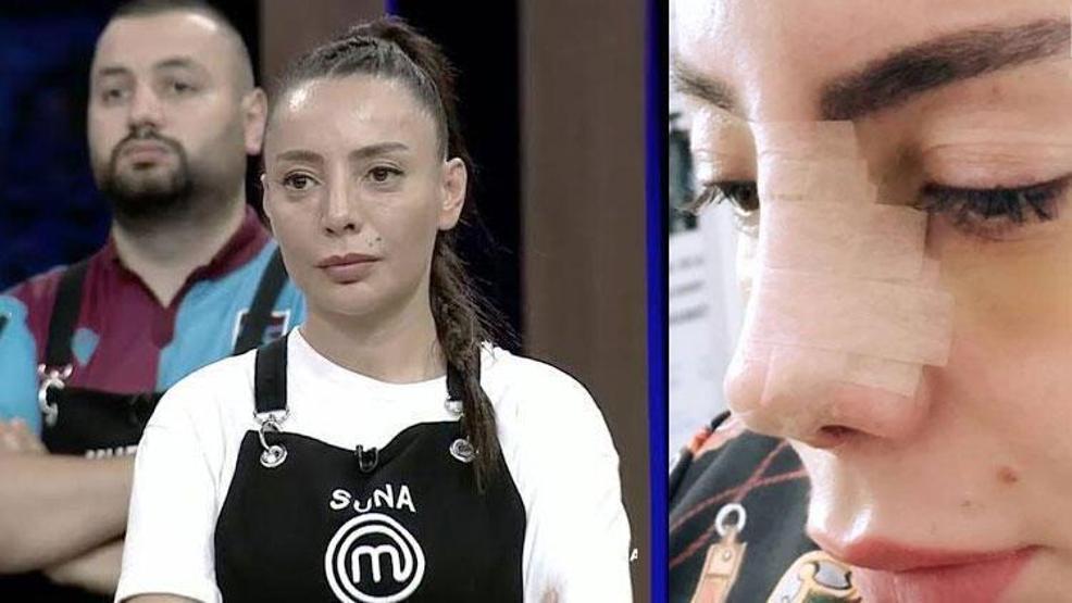 MasterChef Suna Aydının değişimi olay oldu Görenleri şaşırttı