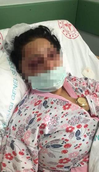 Eşini sokak ortasında döven koca; ‘Ailevi mesele karışmayın, bu işi burada bitireceğim’ diye bağırmış